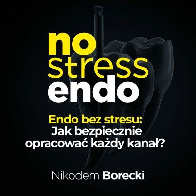 Endo bez stresu: Jak bezpiecznie opracować każdy kanał?