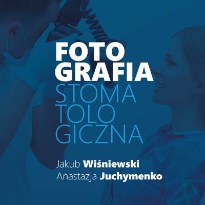 Kompozyt warstwa po warstwie – Estetyczna odbudowa zębów przednich – Medicover